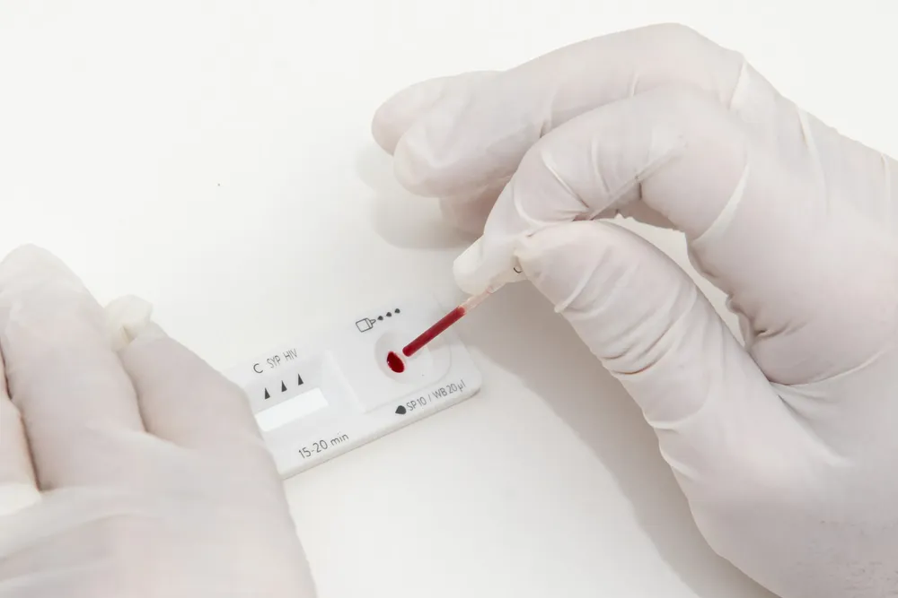test hiv